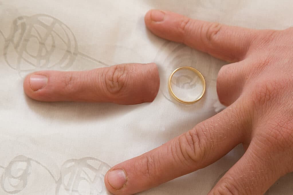 photo of a hand with a detached finger and a wedding ring nearby