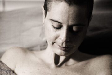 photo of woman showing her mastectomy scar