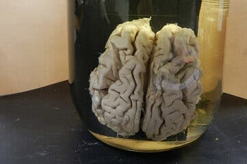 photo of a human brain in a jar